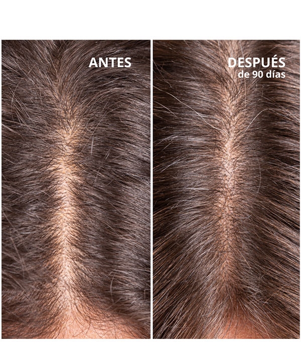 HAIR GROWTH & DENSITY TREATMENT