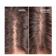 HAIR GROWTH & DENSITY TREATMENT