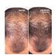 HAIR GROWTH & DENSITY TREATMENT